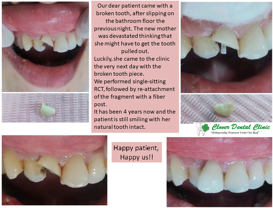 clover dental patient stories