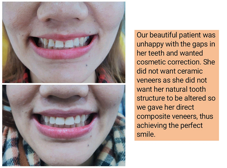 https://cloverdentalclinic.co/wp-content/uploads/2024/03/dental-success-stories.png